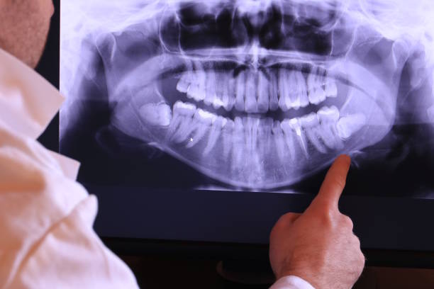 Best Emergency Dentist for Knocked-Out Tooth in Palacios, TX